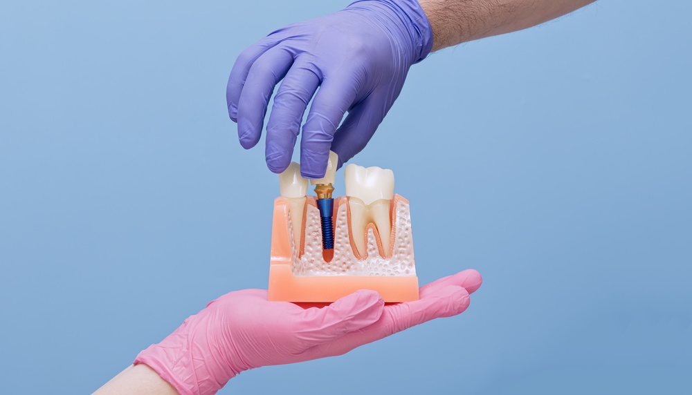 is it possible to get a single tooth implant